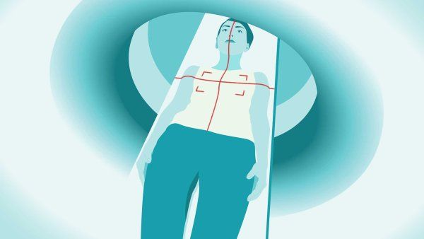 A graphic illustration of a person undergoing a C T scan.