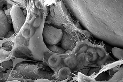 An image obtained with a scanning electron microscope