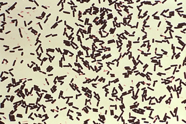 Clostridium perfringens is shown in a microscopic image