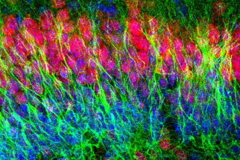 Young neurons (green/yellow) in the dentate gyrus at birth, alongside more mature neurons (red)
