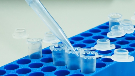 A stock image shows a pipette tip filling in an eppendorf tube