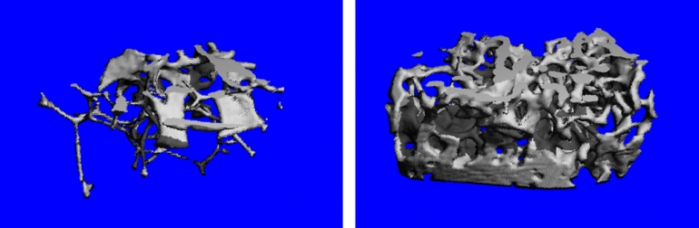 Computer image if a dense femur bone. 