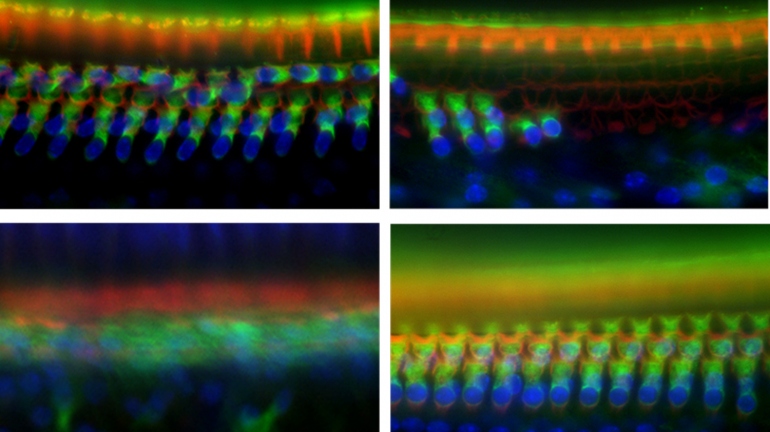 Science images of mouse cochlea in Tmtc4-knockout mice showing hair-cell death.