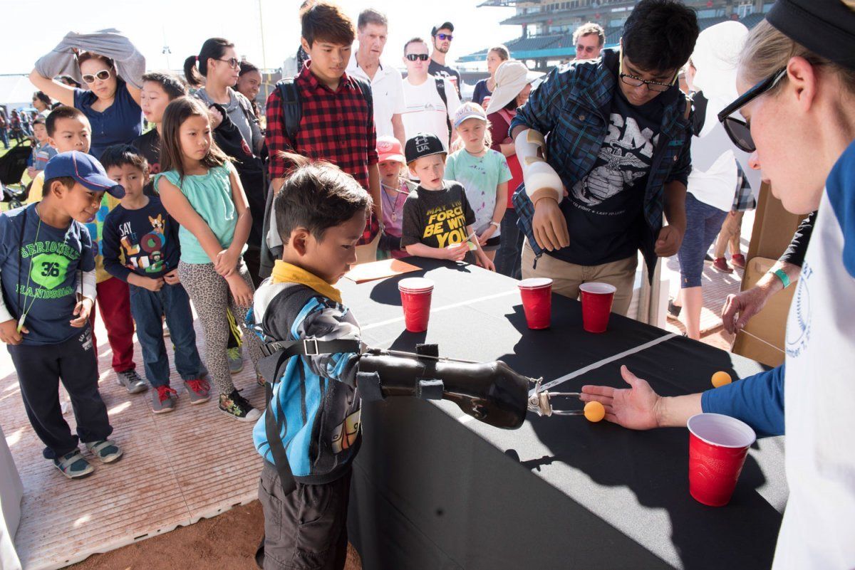 kids try to hold a ping pong ball with prosthetic arm