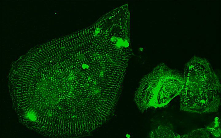 Cardiomyocytes generated from human embryonic stem cells imaged using fluorescent microscopy.
