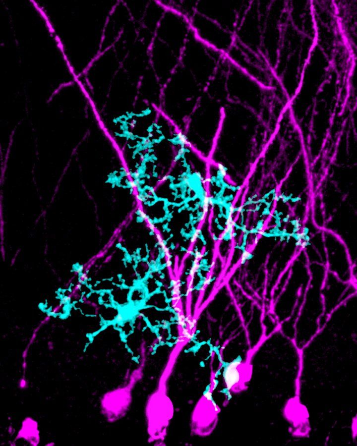 microscopic image of microglia surrounding dendrites in the hippocampus