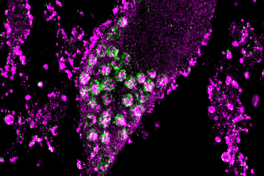 Full-Genome CRISPR Screen Reveals Surprising Ways Neurons Survive ...
