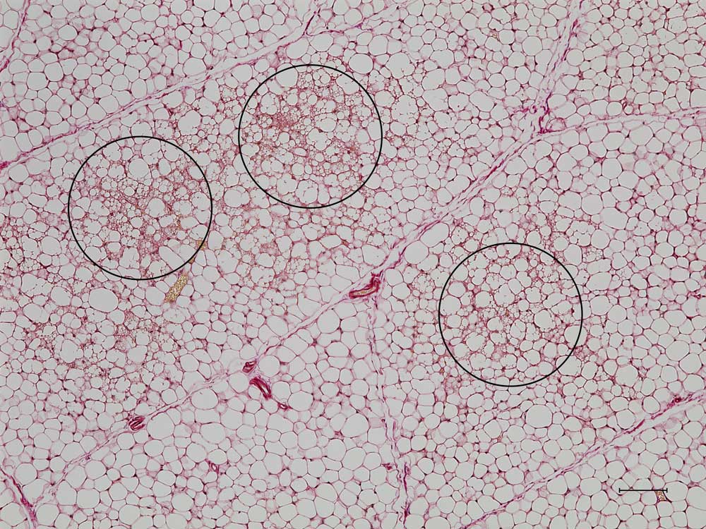 A microscopic image of white and beige fat cells.