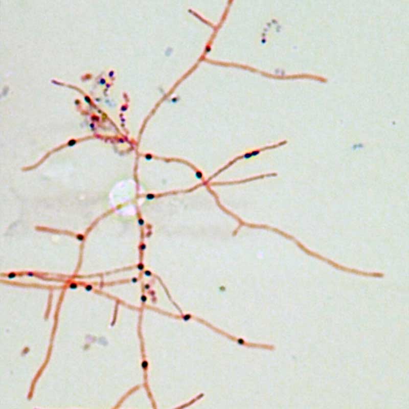 A microscopic image of the bacteria nocardia, which resembles thin, orange branches.