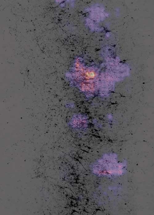 An image showing exising epliectic acitvity, with bright spots of orange and yellow signaling epilepsy.