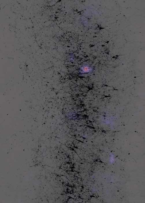 An image showing a decrease in epileptic activity in the brain-an abesence of yellow and orange coloring among darker coloring shows absence of epilepsy.