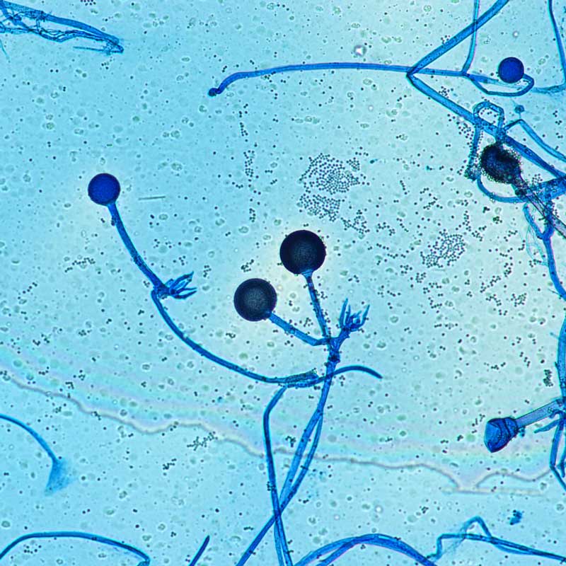 A microscopic image of the fungus Rhizopus, which are long strands with cirucular glands at the end.