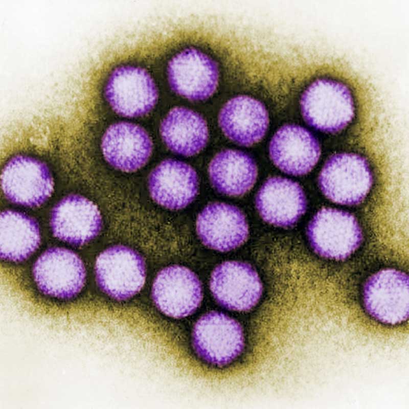 A microscopic image of adenoviruses, which are small purple particles.