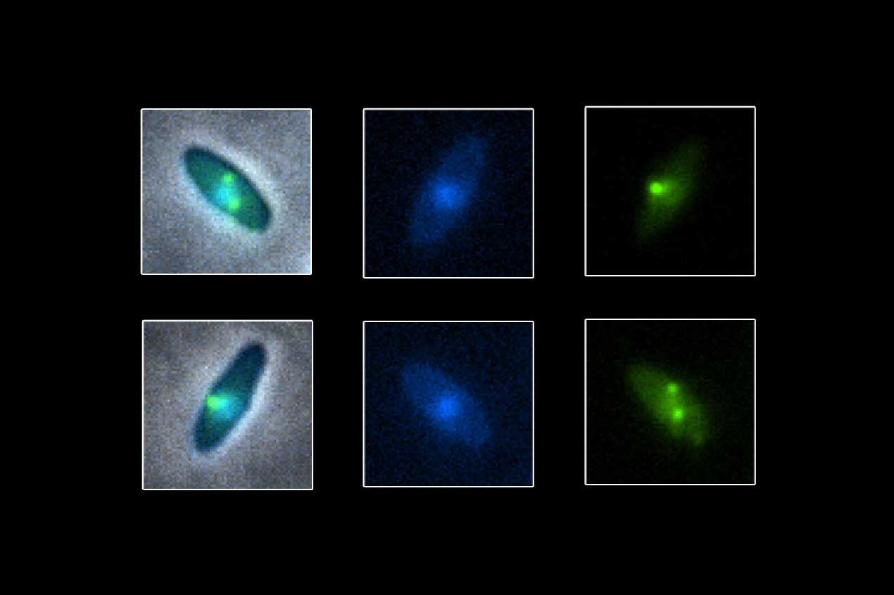 Microscopic images of bacteria infected with PhiKZ jumbo phages, which are shown as bright dots within the pill-shaped bacteria.