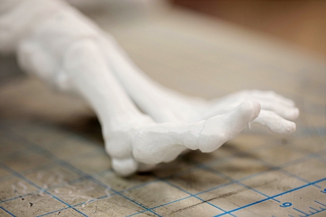 3D-Printed Bones are Helping Doctors Prepare for Surgeries | UC San ...