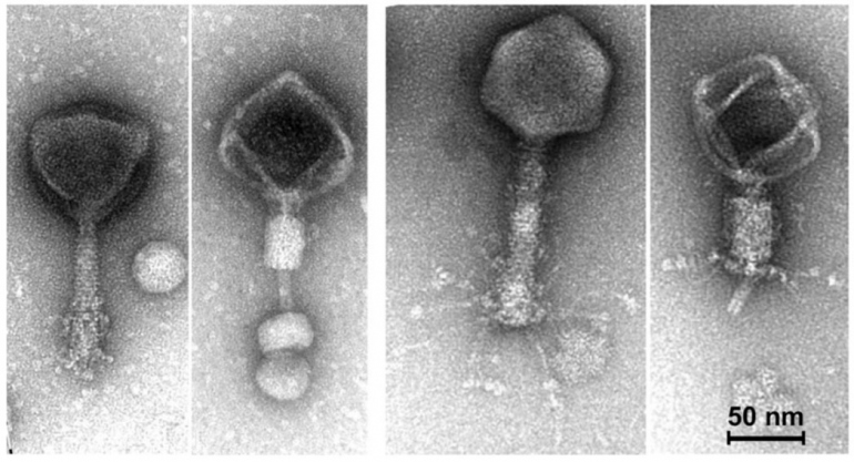 bacteriophage virus electron microscope