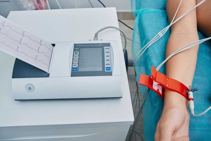 A man with electrodes on his chest gets an electrocardiogram to detect atrial fibrillation.