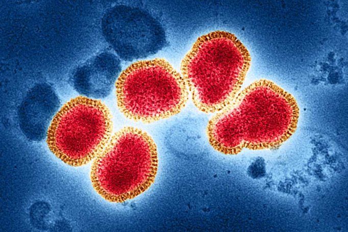 Colorized transmission electron micrograph of influenza A virus particles, colorized red and gold, isolated from a patient sample and then propagated in cell culture.