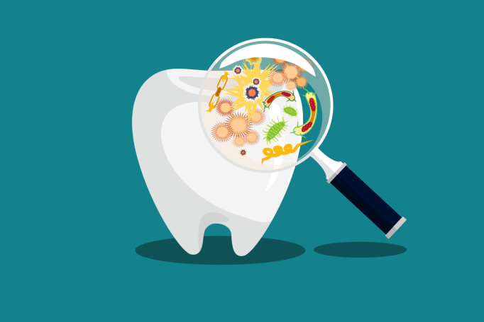 A graphic illustration of a magnifying glass looking closely at microbes on a tooth.