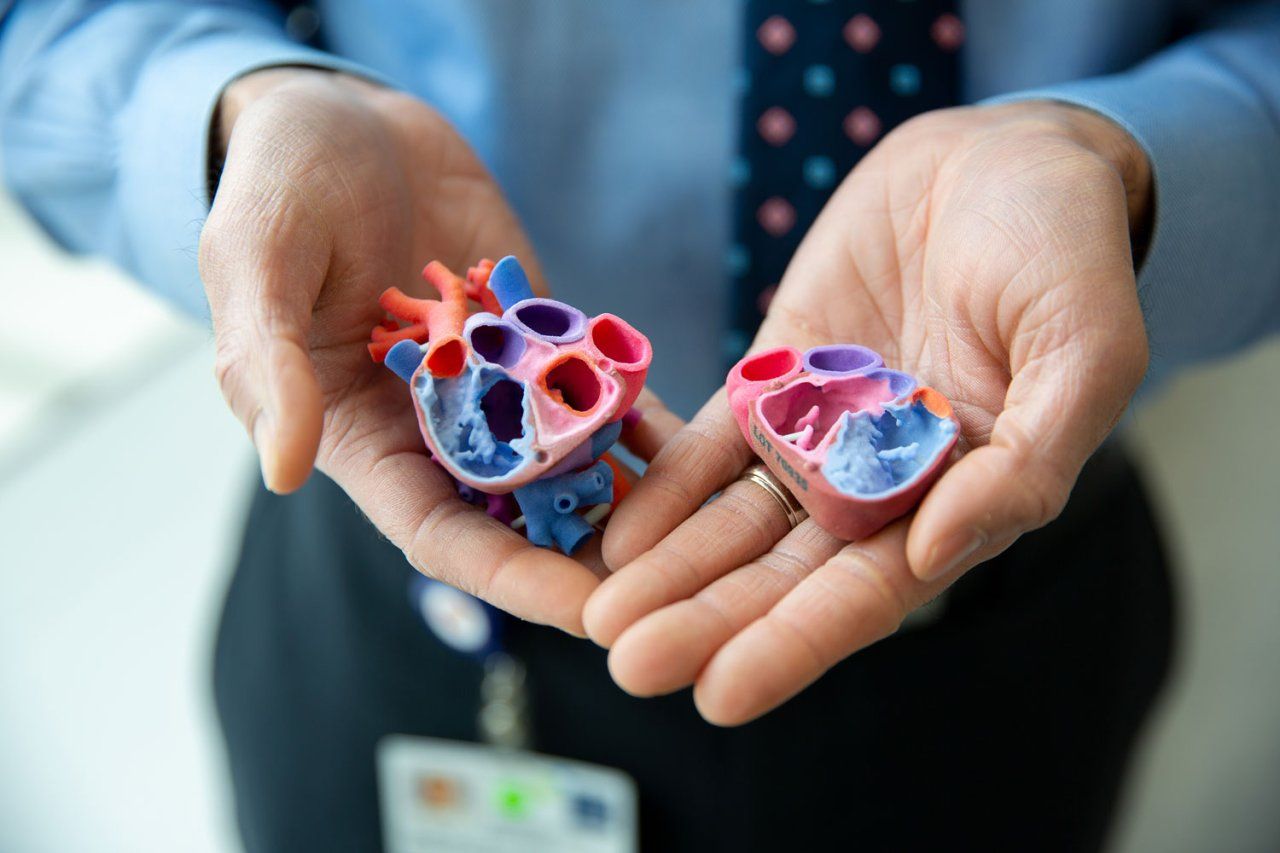How 3D Printer Heart Technology Changed a Teen's Life