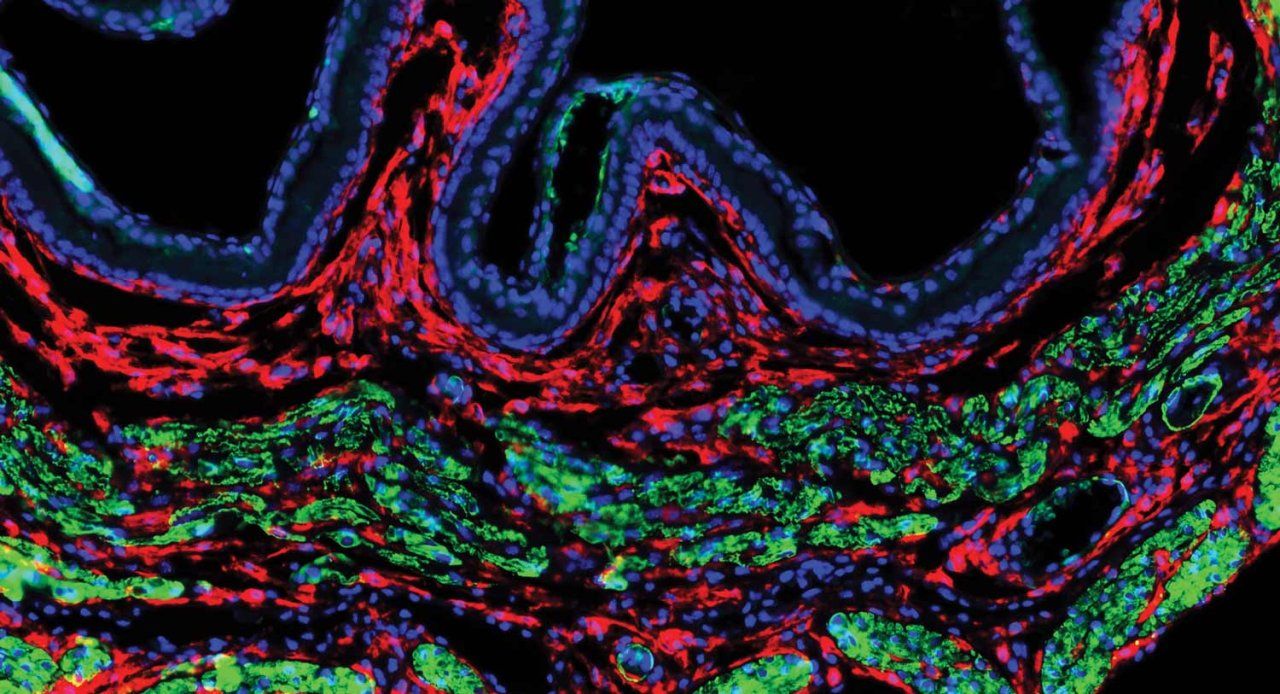 A microscopic image showing colorful red and green fibroblast uterine cells.