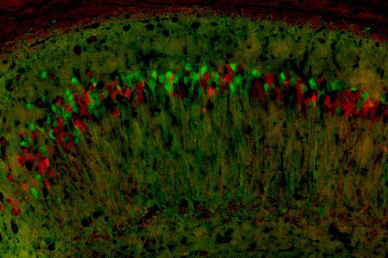 A microscopic image of neurons expressing the mother's X chromosomes in green, and the father's X chromosomes in red.