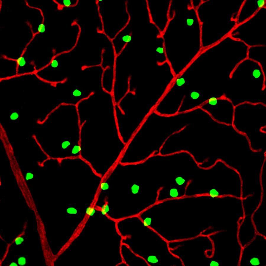 A microscopic image showing neurons (green) in the retina of the eye making blood vessels (red).