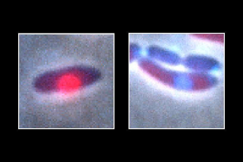 Microscopic images of bacteria infected with PhiKZ jumbo phages, which are shown as bright dots within the pill-shaped bacteria.