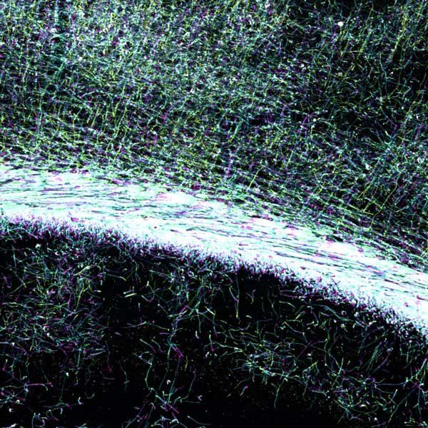 A microscopy showing illuminated myelin in the brain.