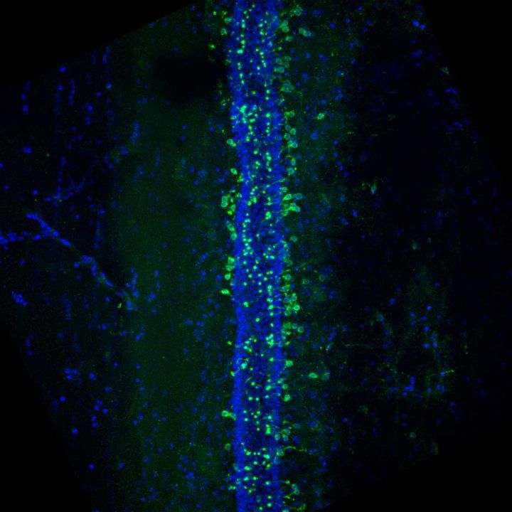 A microscopic image of cerebral spinal fluid-contacting neurons lining the central canal along the spinal cord.