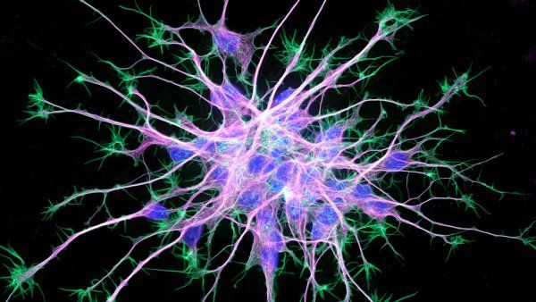 A cluster of neurons with arms branching outwards