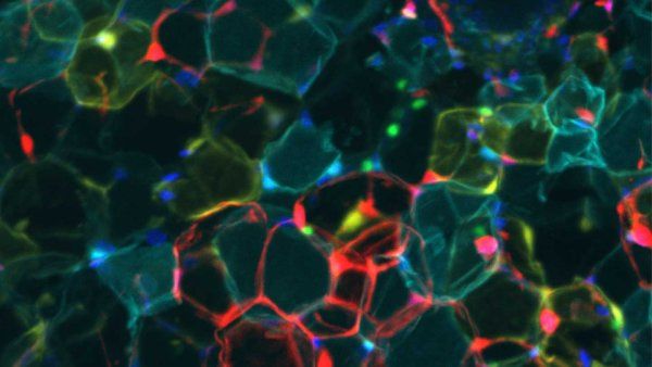 A microscopic image of multicolored cells, which are calorie-storing white fat cells.