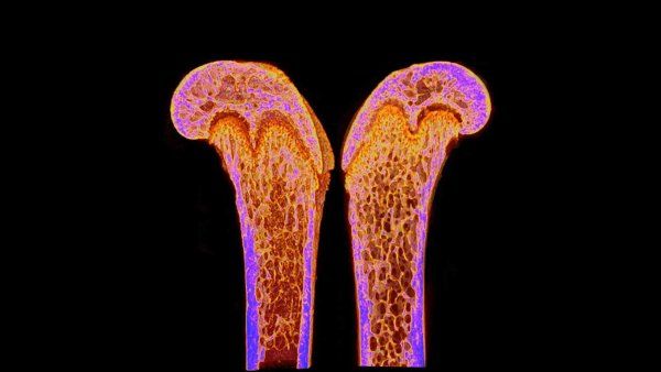 A microscopy of a mouse's femur bone.