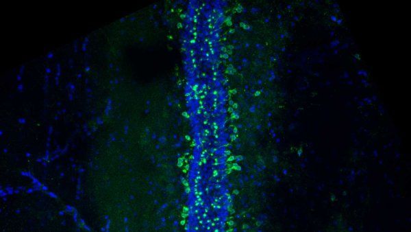 A microscopic image of cerebral spinal fluid-contacting neurons lining the central canal along the spinal cord.