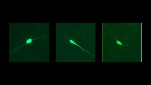 Mircoscopic images of artificial neurons of a human and chimp.