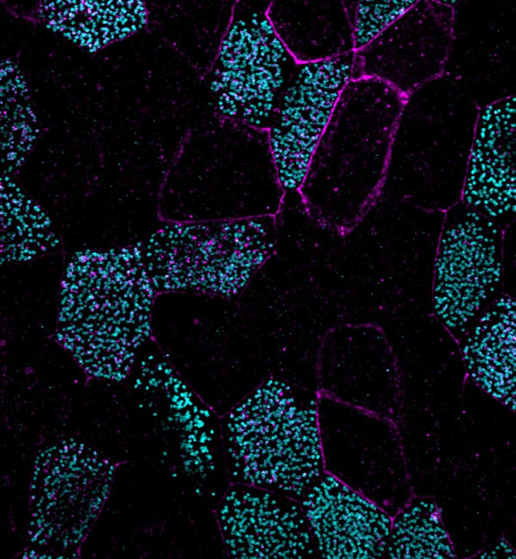 A microscopic image of multiciliated lung cells.