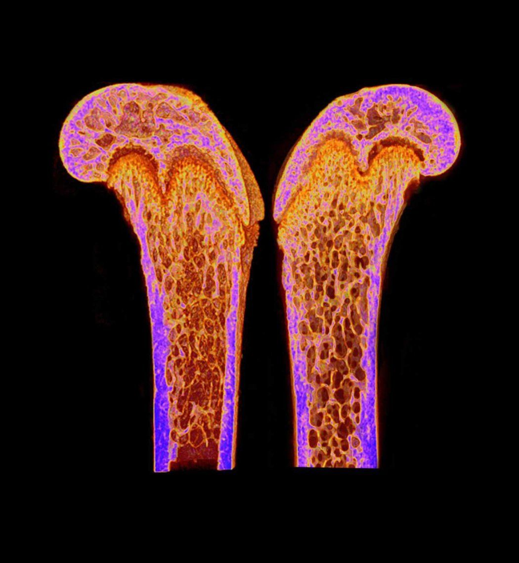 A microscopic image of a mouse's femur.