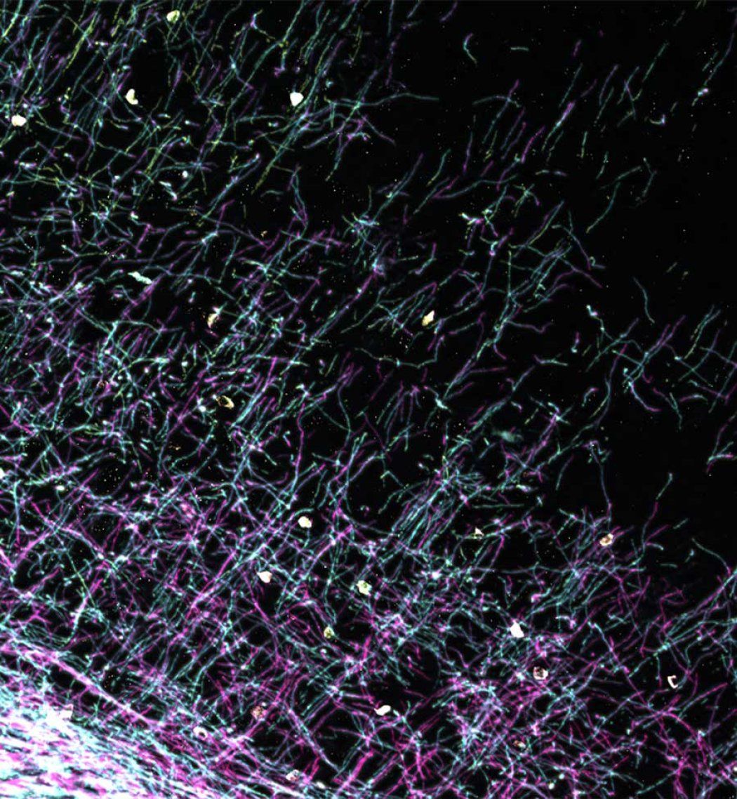 A microscopy showing illuminated myelin in the brain.