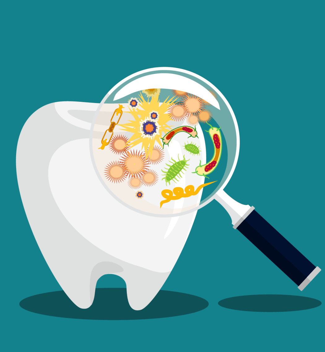 A graphic illustration of a magnifying glass looking closely at microbes on a tooth.