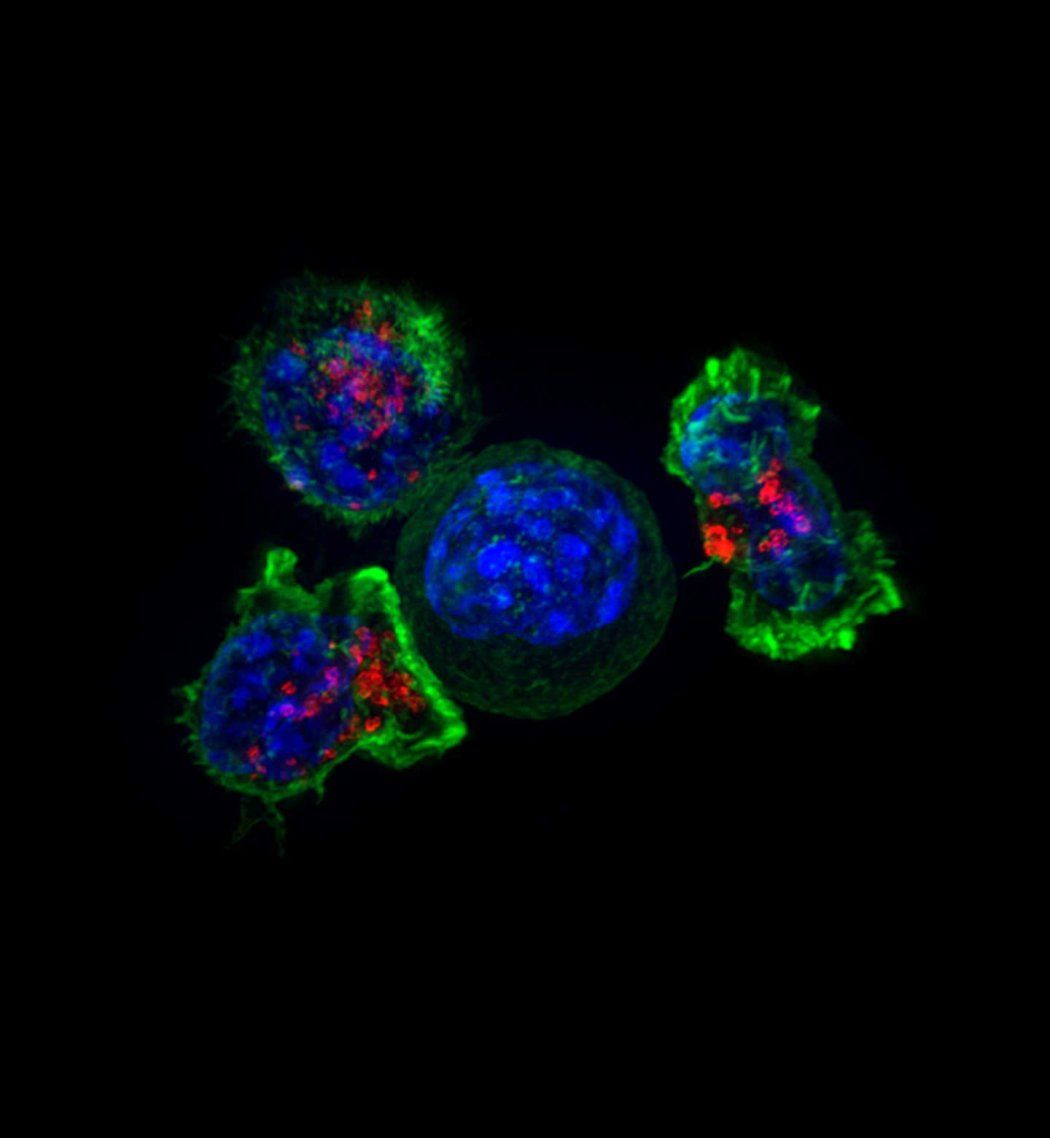 A microscopic image of three killer T cells surrounding a cancer cell.