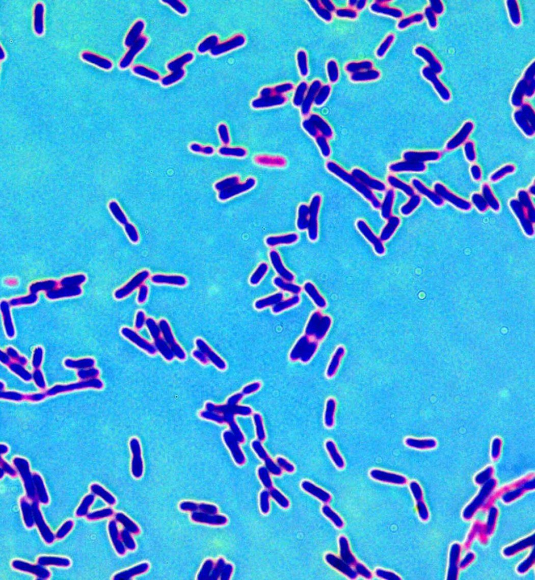 A microscopic image of the bacteria Lactobacillus.