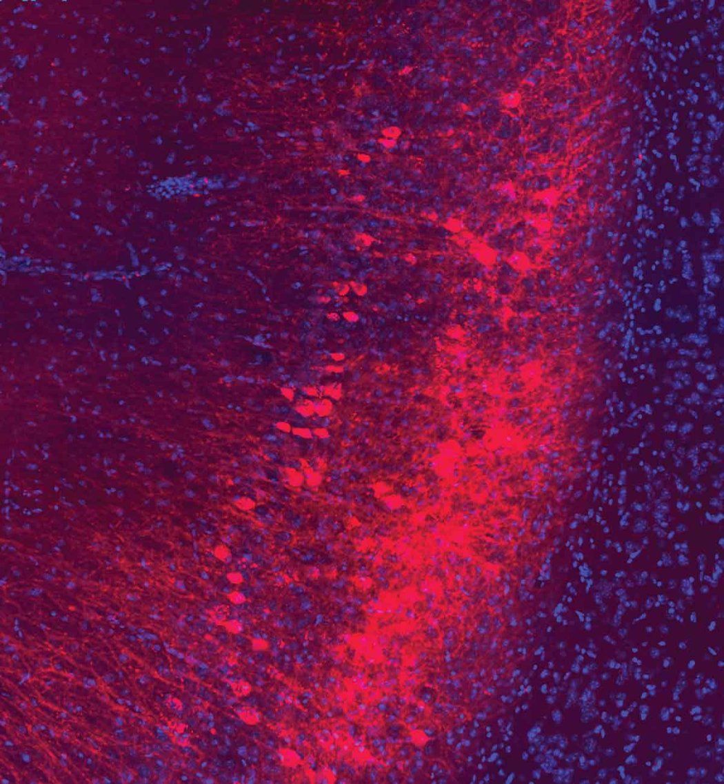 A microscopic image of neurons that connect the hippocamus and amygdala in a mouse's brain. The neurons are dyed red and purple