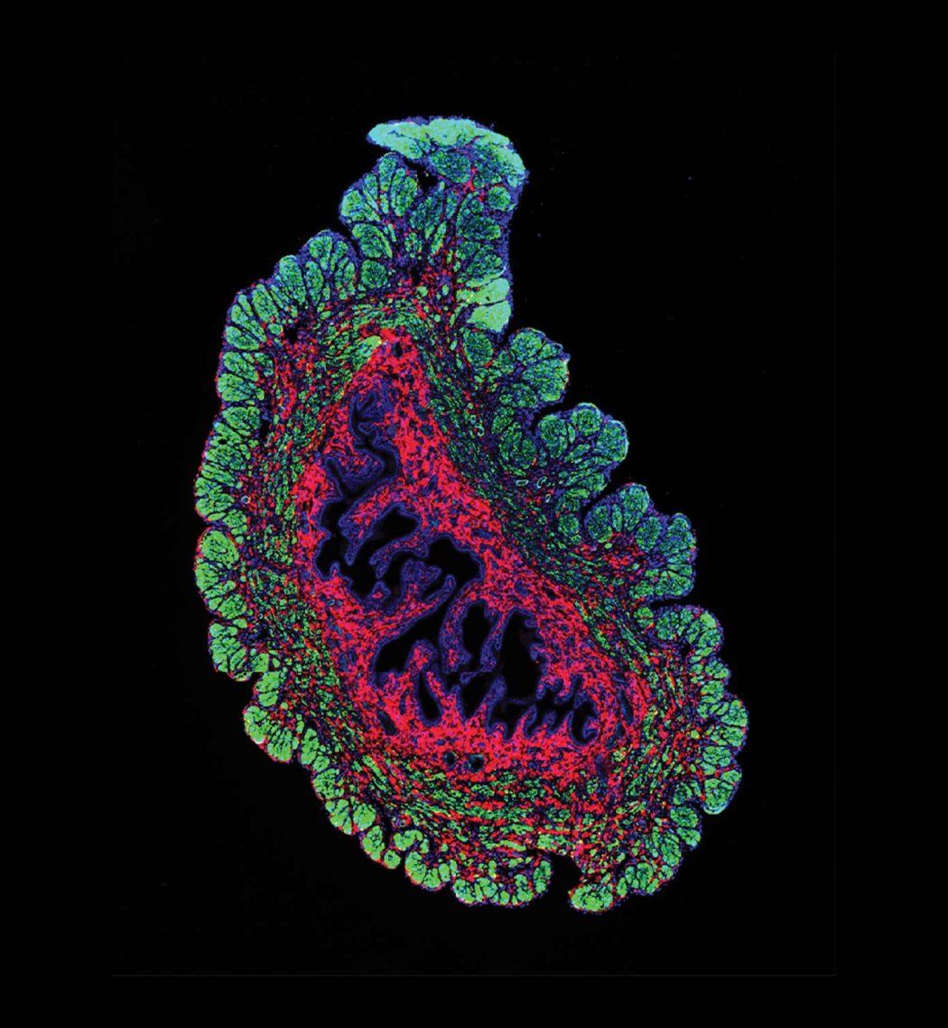 A microscopic image showing colorful red and green fibroblast uterine cells.