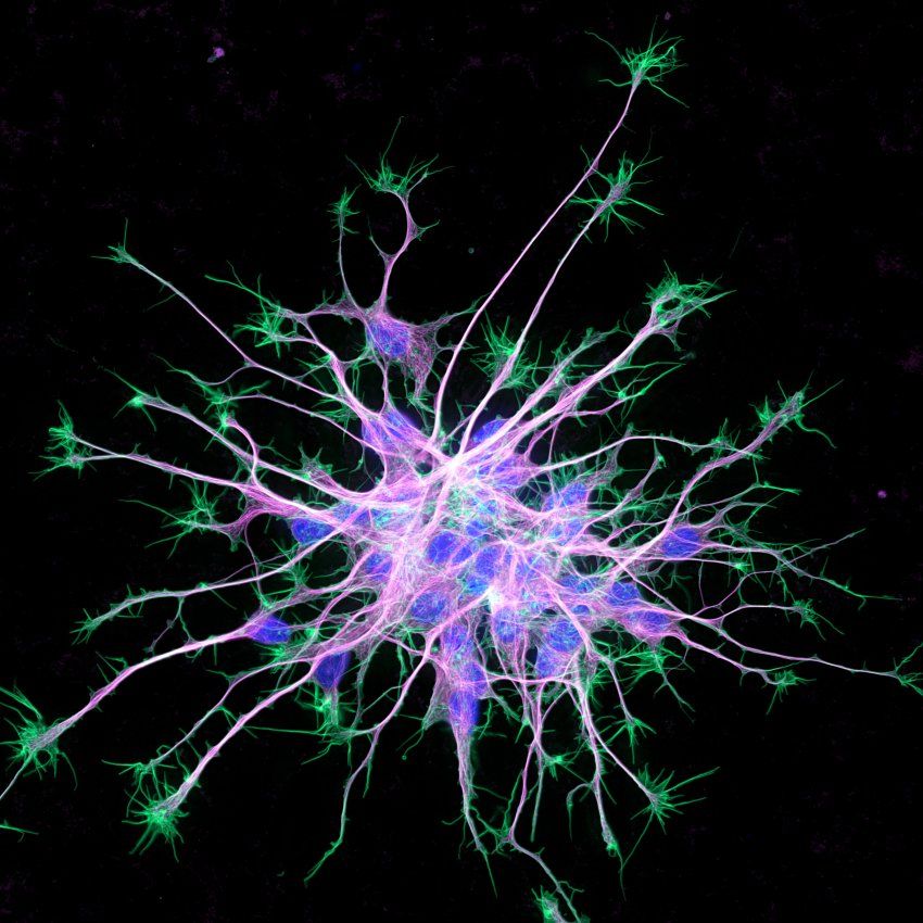A Glimpse Inside Young Neurons Wins 2019 UCSF Sci-Resolution Image